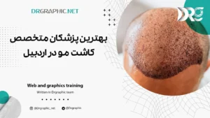 بهترین پزشکان متخصص کاشت مو در اردبیل